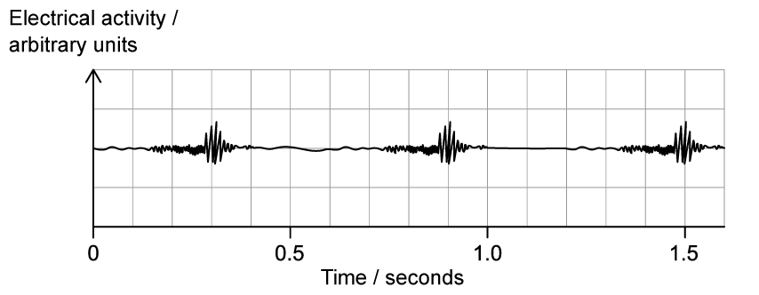 YmFqmZv-_electromyograph---sq